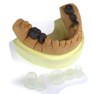 Materiały DIGITALWAX RF Series: Żywice do Metody Odlewania Bezpośredniego Żywice RF są