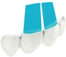DigitalWax D: System Wytwarzania Przyrostowego dla Stomatologii Cyfrowej Dzięki zredukowaniu części ruchomych i niepowtarzalnej prostocie obsługi użytkownika, maszyny DigitalWax charakteryzują się