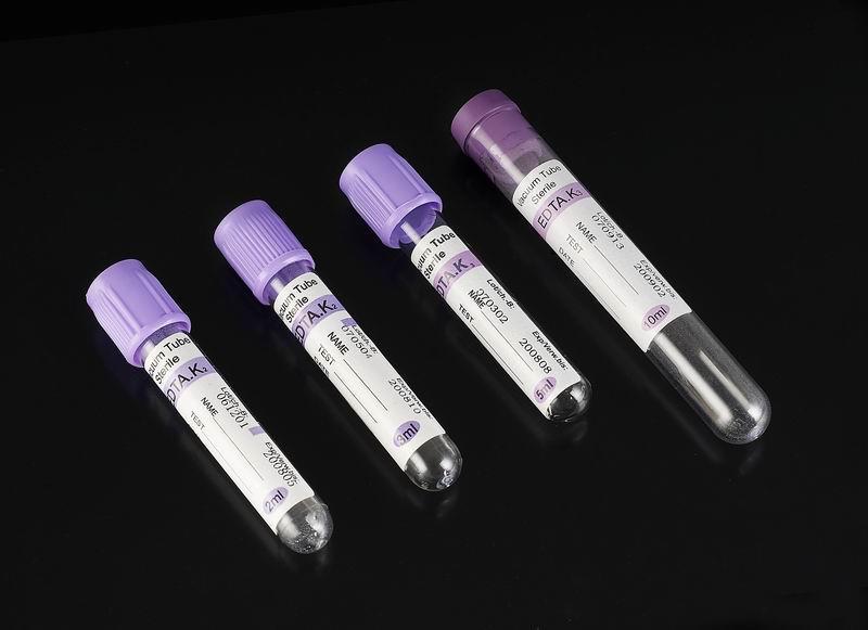 Materiały: W badaniu wykorzystano krew od pacjentów wykazujących kliniczne objawy sepsy (n=62) oraz zdrowych wolontariuszy (n=23).