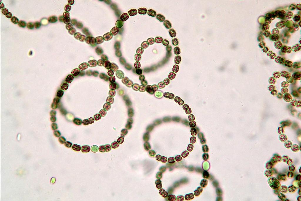 Sinice (Cyanobacteria) z rodzaju Anabaena - powiększenie
