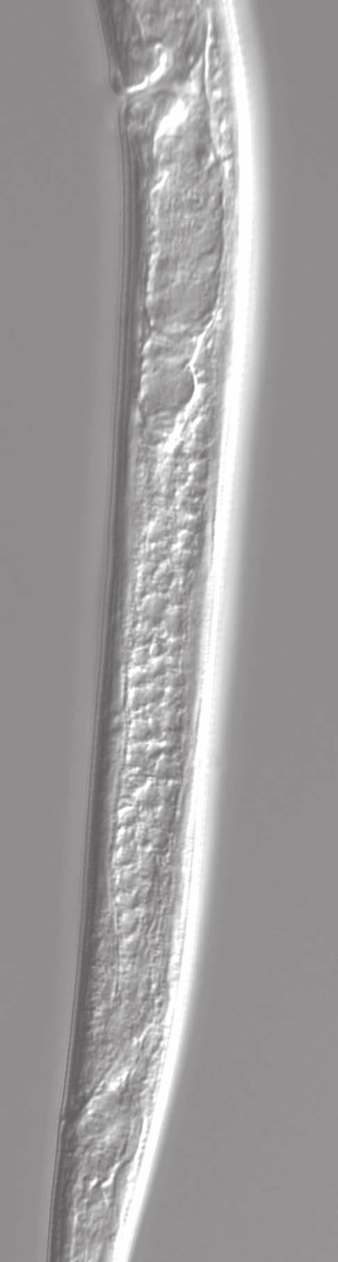 Instrukcja rozpoznawania gatunków z rodzaju Ditylenchus 11 Ditylenchus convallariae (Fot.