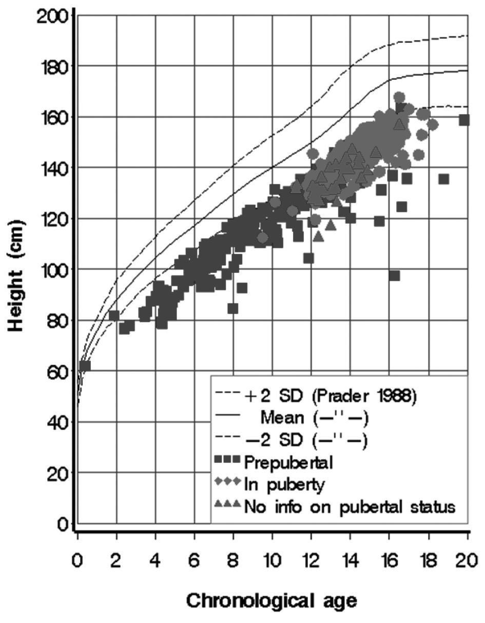 Praca oryginalna Endokrynol. Ped., 12/2013;1(42):17-28 Ryc. 6. Wysokość ciała w SDS przed rozpoczęciem leczenia GH w grupie IGHD oraz grupie OGHD Fig. 6. Height SDS at GH start by Diagnosis: IGHD and OGHD Ryc.