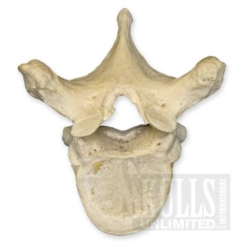 Czym jest Osteopatia? Słowo osteopatia... Słowo "osteopatia" składa się z dwóch greckich określeń: "osteon" i "patos", które można dosłownie przetłumaczyć jako "kości" i "zaburzenia".