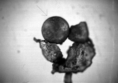 Fig. 9 Nieliczne okazy pyłu były całkiem spore. Tu kulka metaliczna o średnicy 1,5 mm; luty 1992 (foto: J.W.