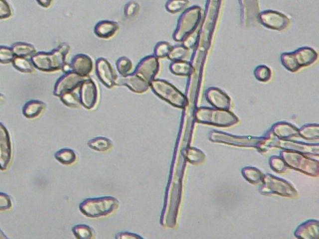 Cladosporium herbarum występujące w mieszkaniach, rozkłada celulozę i wiele innych związków. Wytwarza ochratoksynę o działaniu podobnym do bardzo groźnych mikotoksyn.