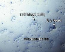 Blaszki są rozbijane na bardzo małe cząstki zwane mikrocząsteczkami