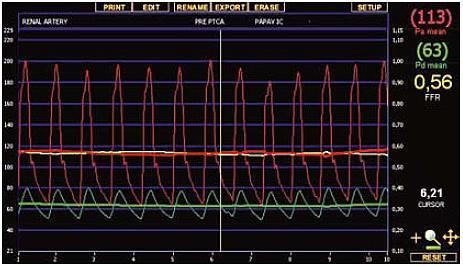 100 mcg i.