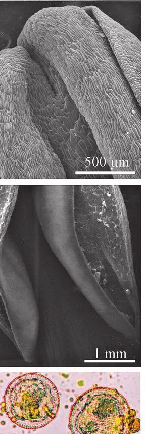 vernus stamens and pollen grains: A -