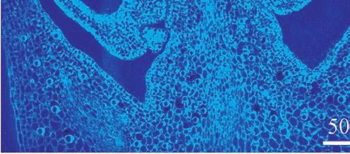calcium oxalate raphides from the parenchymal cells