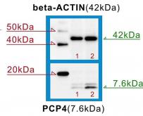 Ryc. 6. Przykładowy wynik Western Blot. Pierwszy rząd z lewej strony reprezentuje marker ze zdefiniowanymi rozmiarami białka, które miało być zidentyfikowane.