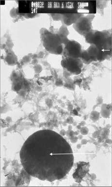 same sample as presented in Fig. 2 and 7). These regions demonstrate sets of parallel pores of very small diameter (~2 nm) (Fig. 10) pointing the formation of more ordered structures.