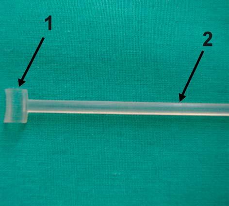 Use of superficial flexor muscle of fingers as a transplant for reconstruction 33 At first (outside the clinic) the patient was surgically treated, FDP seam and dynamic splinting according to