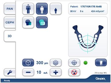 3 Programy pantomograficzne 3.4.1 Technologia redukcji promieniowania rozproszonego SRT (ang.