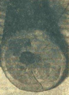 Rura wodociągowa z drewna dębowego z XVI XVIII wieku (wg: Podralski 1982, 195) Fig. 3.