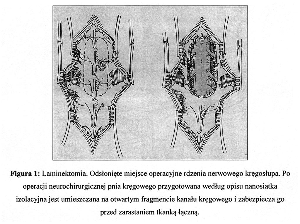 PL 226 479
