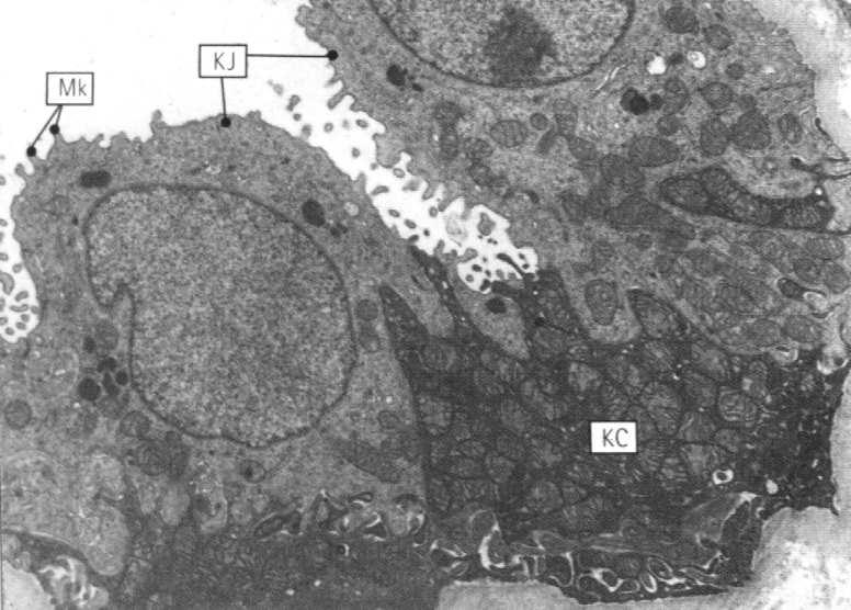 kanały wodne w błonie komórkowej, regulowane przez poziom ADH) resorpcja