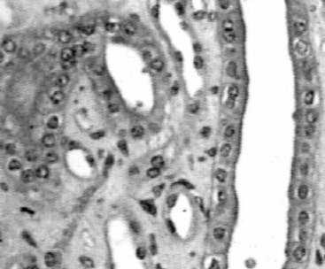fibroblasty - makrofagi - kom.