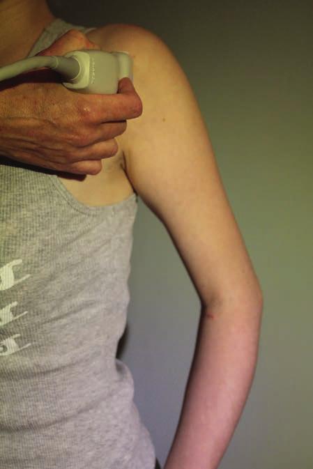 ROZDZIŁ 1 Staw ramienny: Budowa anatomiczna i