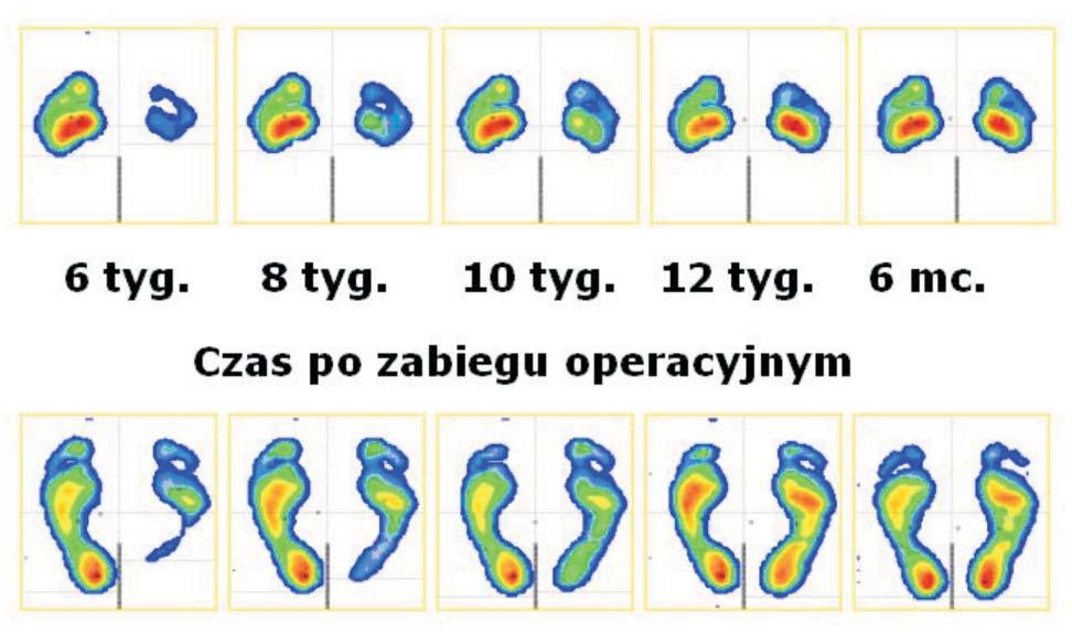 92 J. LORKOWSKI, M. TRYBUS, W. HŁADKI, D. ZARZYCKI trol group.