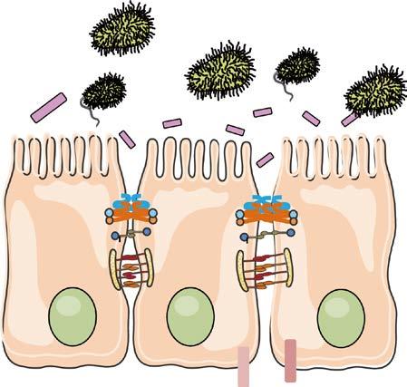 dysbioza Aktywacja immunocytów Uwalnianie cytokin Mediatory zapalenia Komponenty bakteryjne Zwiększenie