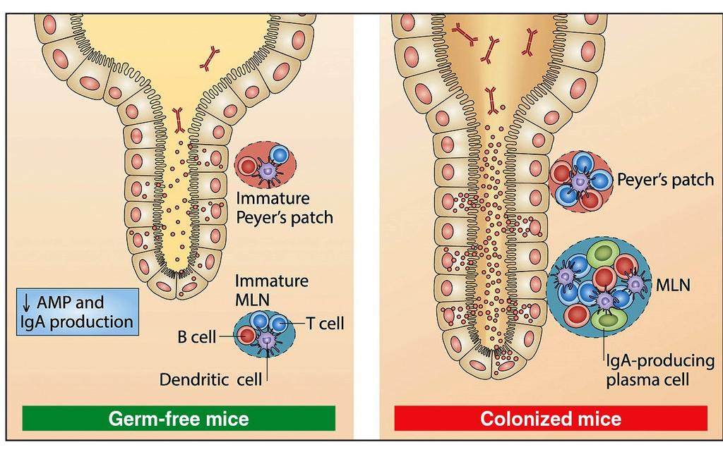 Znaczenie równowagi mikrobiota - gospodarz Zaburzenie równowagi między układem immunologicznym mikrobioty i gospodarza prowadzi do:
