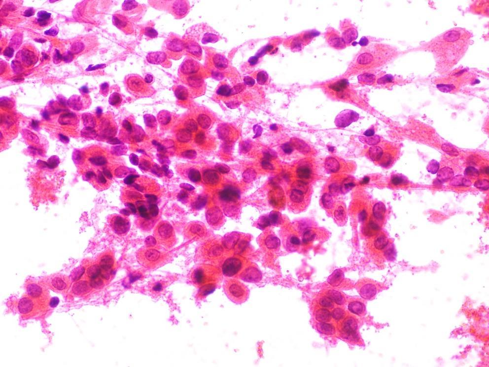 Podstawowe pojęcia Biopsja