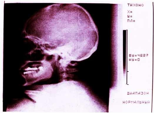 scanning >>> obraz 2D Zalety: