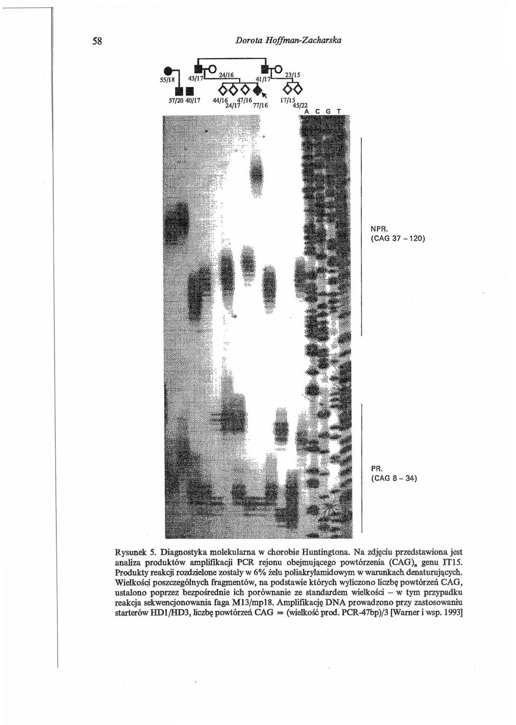 58 Dorota Hoffman-Zacharska NPR. (CAG 37-120) PR. (CAG 8-34) Rysunek 5. Diagnostyka molekularna w chorobie Huntingtona.