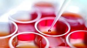 Wyizolowano pojedyncze komórki macierzyste Po raz pierwszy udało się otrzymać pojedyncze ludzkie komórki macierzyste, których różnicowanie można w pełni kontrolować.
