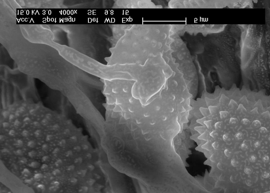 Coleosporium tussilaginis (photo by A. Bartkowska) Phot. 4.