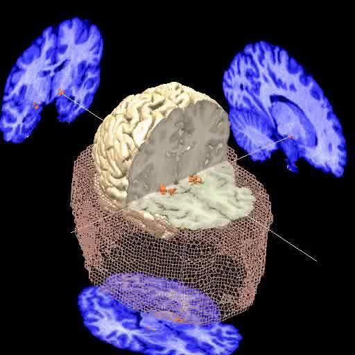 CO BADAMY? EMOCJE POZYTYWNE, NEUTRALNE, NEGATYWNE różnica w poziomie fal alfa pomiędzy prawym i lewym płatem czołowym frontal EEG assymetry concept by Davidson et.