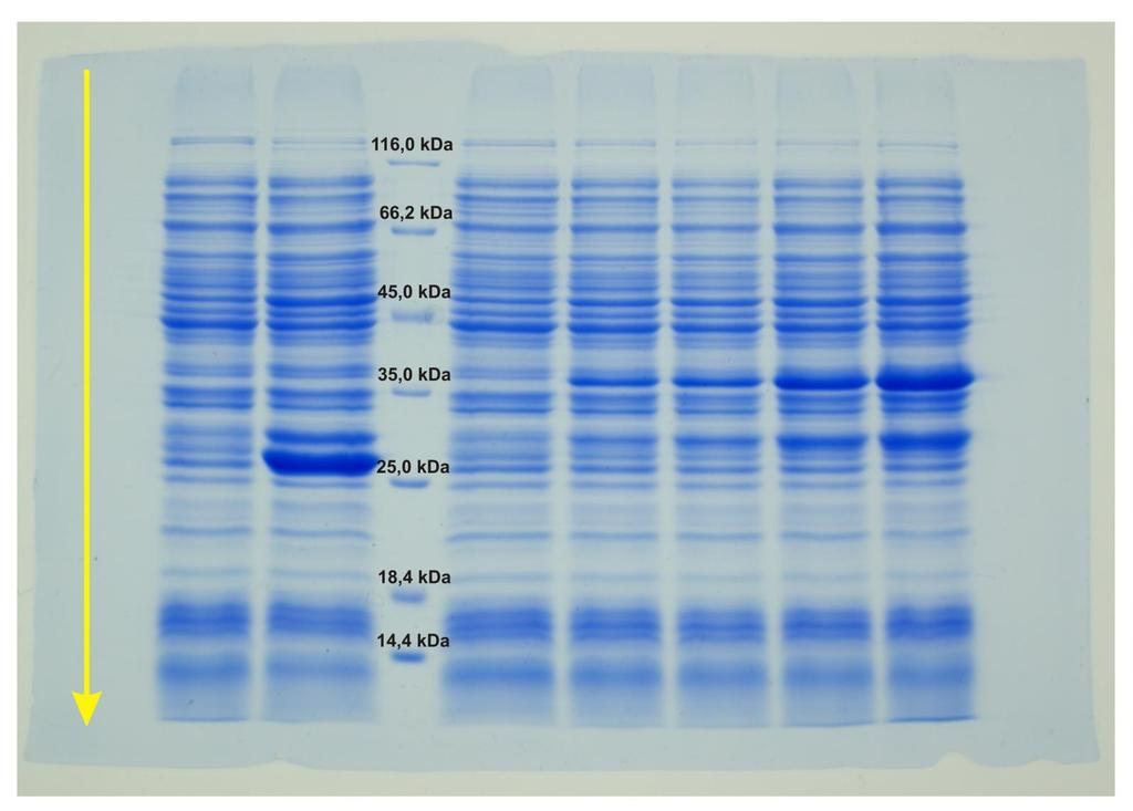 Elektroforeza SDS-PAGE i wizualizacja białek przy