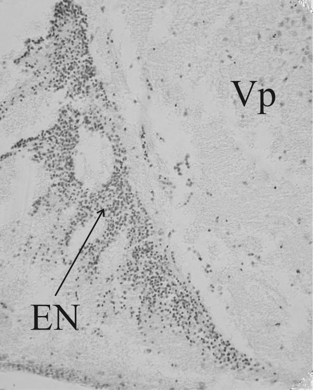 Ryc. 6.4. Area ventralis telencephali, nucleus postcommissuralis oraz nucleus entopeduncularis w powiększeniu Fig. 6.4. The enlargement of the area ventralis telencephali, nucleus postcommissuralis and nucleus entopeduncularis długość 2200 µm.