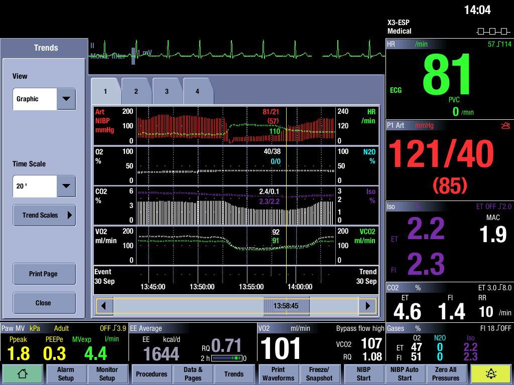 Monitor modułowy CARESCAPE* B650 Aktualne wartości wymiany gazowej są prezentowane w ciągły sposób w polu wartości