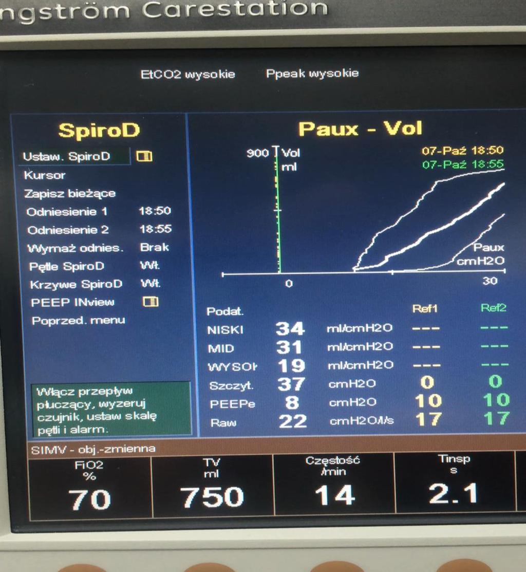 Dynamiczna spirometria ustawienie