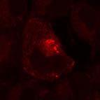GFP amp R amp R