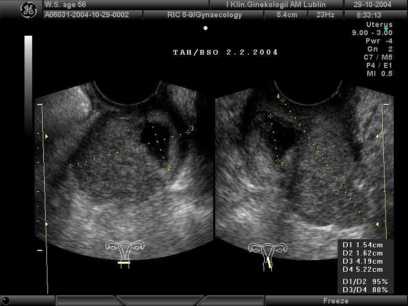 Ryc.3.