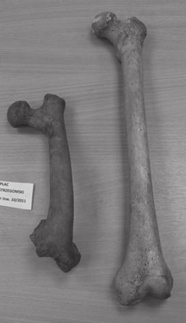 Do schorzeń możliwych do obserwacji w materiale szkieletowym należą: zmiany rozwojowe, urazy, choroby zapalne swoiste i nieswoiste, zmiany degeneracyjne, zaburzenia układu wewnątrzwydzielniczego,
