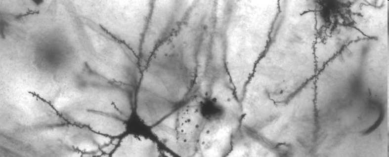 Neurony odbieranie i przekazywanie sygnałów Komórki