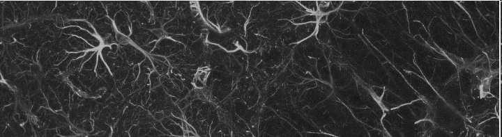 * makroglej Komórki glejowe astrocyty (komórki gwiaździste) największe komórkami glejowe (8 15 µm) otaczają