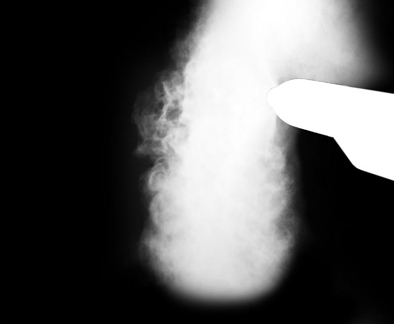 Opatentowana technologia DVC, czyli system cyfrowej kontroli zaworów zapewnia dokładne odmierzanie i powtarzalną ilość proszku.