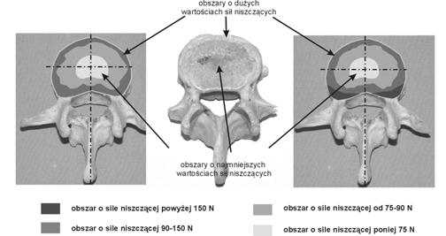 Wyniki te uzupełniły otrzymane wcześniej wartości i były podstawą od wyznaczenia obszarów najbezpieczniejszych do osadzania implantów międzytrzonowych oraz rejonów najsłabszych pod względem