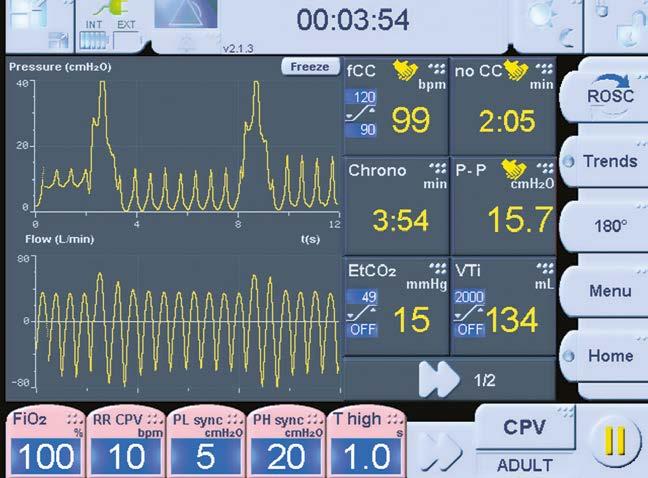 ekranie: częstotliwość uciśnięć klatki piersiowej na minutę cel: 100/min Monitorowanie wydychanego CO 2 (etco 2