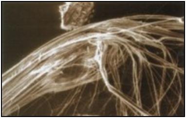 Zdjęcie 1 Włókna azbestowe powiększone 1000 razy Azbest poddawany obróbce może rozpadać się na mniejsze cząsteczki i może też być rozszczepiany.