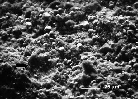 282 W. GRZEBIELUCH, R. ADAMSKI endodontycznego waha się 85 90% [cyt. wg 7]. Obecnie powszechnie uznawanym materiałem do wypełniania kanału korzeniowego jest gutaperka.