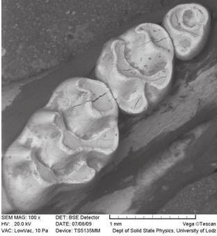 J Stoma 2013; 66, 1 Gibek J., Pawłowska E., Klimek L., Szczepańska J. Fig. 5. Standard mouse molars. Zęby trzonowe myszy standardowej.