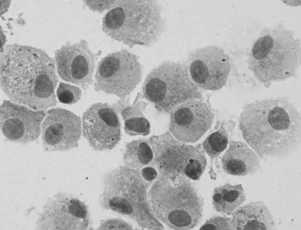 Makrofagi fagocytują i trawią mikroorganizmy, uszkodzone komórki, szczątki
