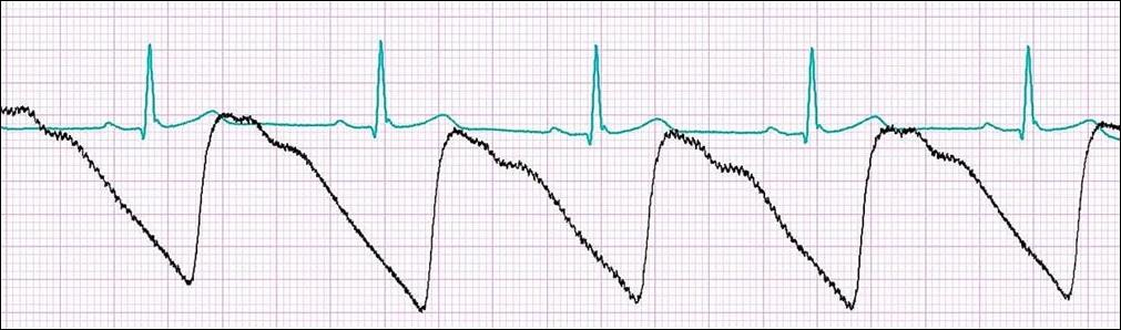 Analiza sygnałów, wyznaczanie HR Sygnały ECG i
