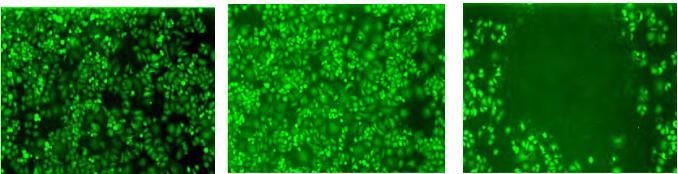 IV. tylko laser tylko nanoshells laser + nanoshells Kalceina AM (barwi tylko żywe komórki) Hirsh L.R. et al.. Proc. Nat. Acad. Sci.
