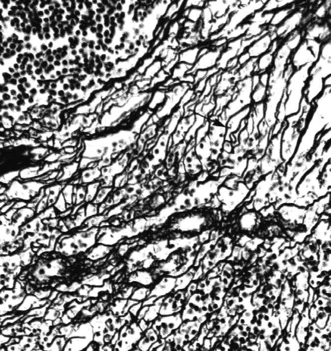 Tkanka łączna siateczkowa: komórki z wypustkami (głównie fibroblasty i